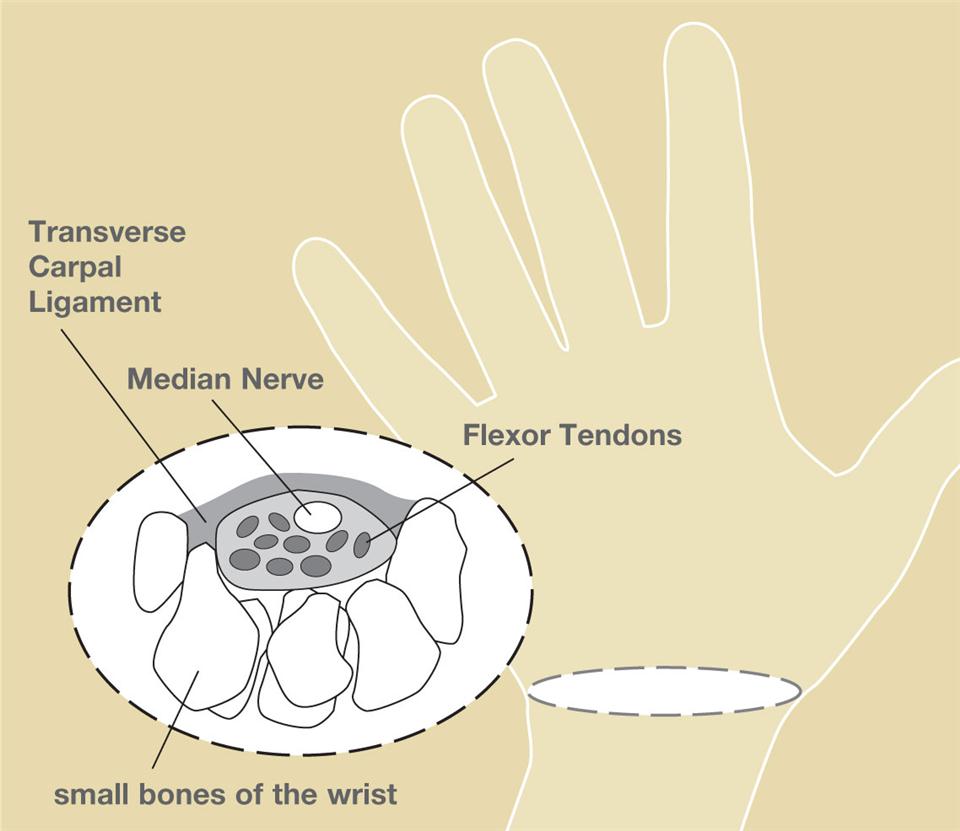 Copyright American Society for Surgery of the Hand