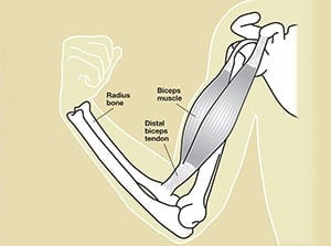 Anatomy of the arm showing bones, muscles, and tendons including radius bone, biceps muscle, and distal biceps tendon for detailed muscle and skeletal structure understanding.