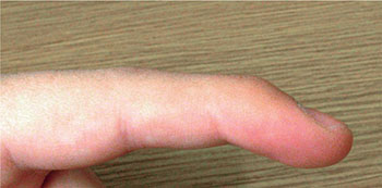 Close-up of a human finger pointing at a wooden surface, showing skin texture and natural color, ideal for dental or medical context related to oral health and anatomy.