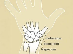 Illustration of wrist bones, including metacarpal, carpal bones, basal joint, and trapezium, highlighting wrist joint structure for medical and educational context.