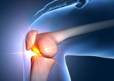 A detailed illustration of knee joint pain showing inflammation and injury in the knee area, highlighting issues related to knee arthritis or ligament strain for health-related SEO keywords.