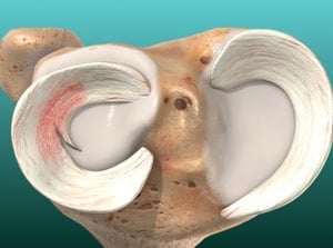 A detailed illustration of a human ear model showing the outer ear, ear canal, and earlobe, highlighting ear anatomy for medical education and healthcare purposes.