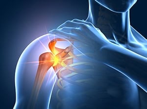 Close-up of a digital illustration showing shoulder pain with highlighted inflamed shoulder joint and muscle strain, emphasizing shoulder injury and pain relief.